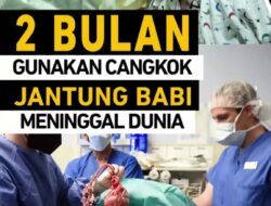 David Bennet Pasien Pertama Yang Menjalani Transplntasi Jantung Babi meninggal Dunia 8 Maret